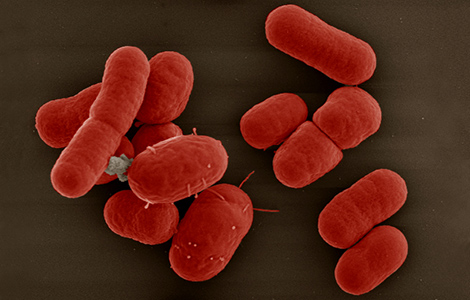 Acinetobacter baumannii. Rasterelektronenmikroskopie. Quelle: © Gudrun Holland; Kolorierung: Michael Laue/RKI