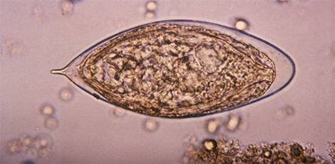 Mikroskopische Aufnahme eines Eis von Schistosoma haematobium, dem Erreger der Blasen-Bilharziose. Quelle: © CDC