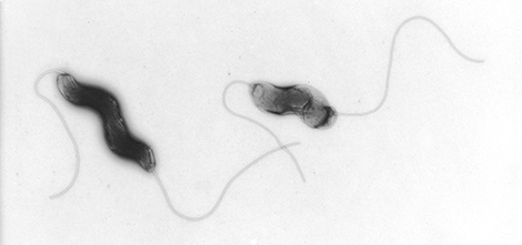 Campylobacter jejuni, Vergrößerung 40000–fach. Quelle: © Hans R. Gelderblom/RKI