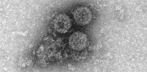 Chikungunya virus, Sindbis virus. Transmissions-Elektronenmikroskopie, Negativkontrastierung. Quelle: © Lars Möller (2012)/RKI