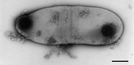 Corynebacterium diphtheriae mitis, Primärvergrößerung x 25000, Darstellung mit Polkörnchen. Quelle: © Hans R. Gelderblom/RKI