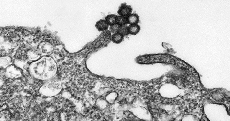 Gelbfiebervirus, Yellow fever virus, YFV, Gelbfiebervirus auf Vero-Zellen, Primärvergrößerung x 20000. Quelle: © Muhsin Özel/RKI