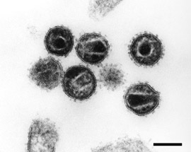 HIV-1 (Retroviren). Transmissions-Elektronenmikroskopie, Ultradünnschnitt. Maßstab = 100 nm. Quelle: © Hans R. Gelderblom/RKI