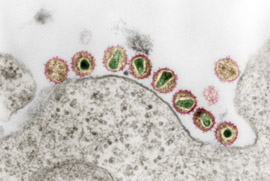 HIV-1 (Retroviren). Transmissions-Elektronenmikroskopie, Ultradünnschnitt.  Quelle: © Hans R. Gelderblom. Kolorierung: Andrea Schnartendorff/RKI