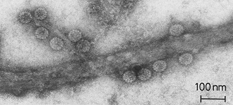 Papillomavirus aus Hautwarze. Transmissions-Elektronenmikroskopie. Negativkontrastierung. Präparations-Nr. #831. Quelle: © Hans R. Gelderblom/RKI