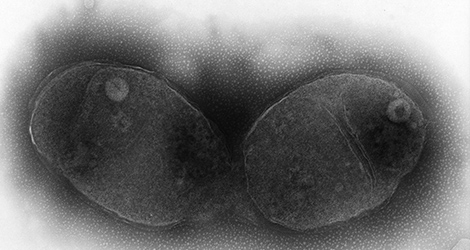 Haemophilus influenzae  020275.Haemophilus influenzae 020275; Negativ-Kontrastierung; Elektronenmikroskopie, Vergrößerung 100000–fach. Quelle: © Hans R. Gelderblom/RKI