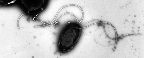 Helicobacter pylori #799, Vergrößerung 10000–fach, #3912; Proteobacteria; delta/epsilon subdivisions; Epsilonproteobacteria. Quelle: © Hans R. Gelderblom, Rolf Reissbrodt/RKI