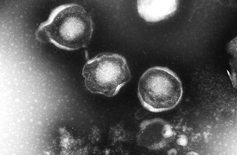 HHV-1, Human herpesvirus 1, HSV-1, Herpes simplex virus 1. Transmission electron microscopy, negative staining. Quelle: © Hans R. Gelderblom (1994)