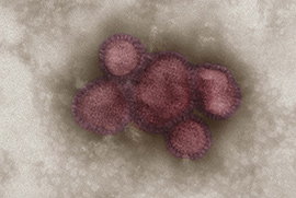 Influenzavirus A/California/7/2009 (H1N1), koloriert, Negativkontrastierung im Transmissionselektronenmikroskop (TEM) Primärvergrößerung x 85000. Quelle: © Gudrun Holland, N. Bannert/RKI