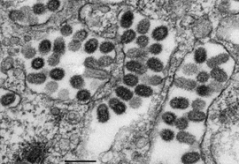 Influenza A(H5N1)-Virus, Erreger der Vogelgrippe. Transmissions-Elektronenmikroskopie, Ultradünnschnitt. Maßstab = 200 nm. Quelle: © RKI