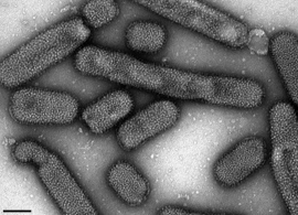 Influenza A(H1N1)-Virus. Transmissions-Elektronenmikroskopie, Negativkontrastierung. Maßstab = 100 nm. Quelle: © RKI