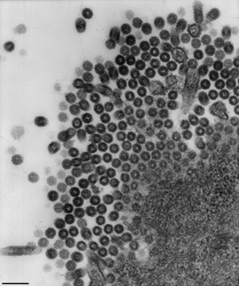 Influenza A-KP-Stamm, Klassische Geflügelpest. Transmissions-Elektronenmikroskopie, Ultradünnschnitt. Maßstab = 200 nm. Quelle: © RKI