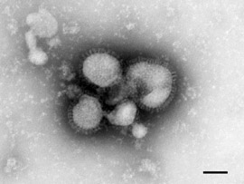 Influenza A(H5N1)-Virus, Erreger der Vogelgrippe. Transmissions-Elektronenmikroskopie, Negativkontrastierung. Maßstab = 50 nm. Quelle: © Norbert Bannert, Lars Möller/RKI