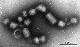 Influenza A(H1N1)-Virus. Primärvergrößerung x 98000. Quelle: © Norbert Bannert, Lars Möller/RKI