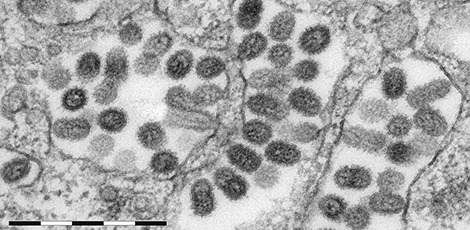 Influenza A Virus (H5N1), Vogelgrippe, (Orthomyxoviren). Transmissions-Elektronenmikroskopie, Ultradünnschnitt. Maßstab = 200 nm. Quelle: © Norbert Bannert, Freya Kaulbars/RKI