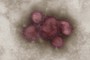 Influenzavirus A/California/7/2009 (H1N1), koloriert, Negativkontrastierung im Transmissionselektronenmikroskop (TEM) Primärvergrößerung x 85000. Quelle: © RKI