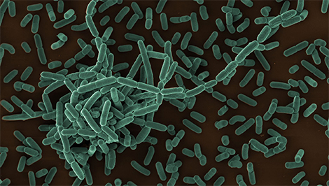 Listeria monocytogenes wildtype EGD. Scanning electron microscopy. Bar = 1 µm. Quelle: © Robert Koch-Institut / Petra Kaiser (2013).
