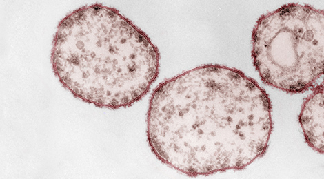 Masern-Viren unter dem Transmissions-Elektronenmikroskop. Quelle: © Gelderblom, Kolorierung: Schnartendorff/RKI