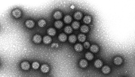 Rotaviren, Vergrößerung 100000–fach, schwere Diarrhoe bei Kindern und Alten; fatale Dehydrierung. Elektronenmikroskopie. Quelle: © Hans R. Gelderblom/RKI