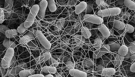 Salmonella enterica Subspecies enterica Serovar Typhimurium (Salmonellen), Bakterienkolonie. Raster-Elektronenmikroskopie. Maßstab = 1 μm. Quelle: © Muhsin Özel, Gudrun Holland, Rolf Reissbrodt/RKI