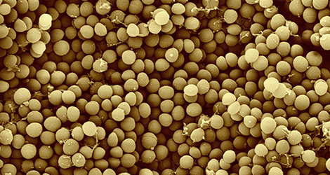 Staphylococcus aureus. Raster-Elektronenmikroskopie.Quelle: © Gudrun Holland, Michael Laue/RKI