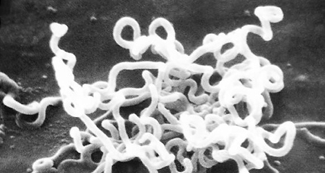 Das Bakterium Treponema pallidum ist der Verursacher der Syphilis. Quelle: © CDC/Dr. David Cox