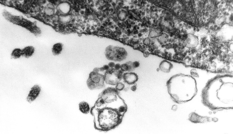 RUBV, Rubella virus, Primärvergrößerung x 30000, Rötelnvirus. Quelle: © Muhsin Özel/RKI