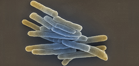 Mycobacterium tuberculosis. Längsschnitt. Elektronenmikroskopie. Bar = 1 µm. Quelle: © Gudrun Holland 2013, Kolorierung: Andrea Schnartendorff/RKI