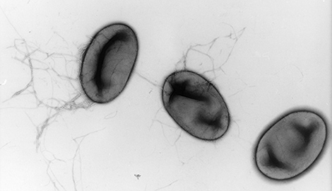 Salmonella enterica Subspecies enterica I Serovar Typhymurium, Vergrößerung 32775–fach. Quelle: © Hans R. Gelderblom, Rolf Reissbrodt/RKI 