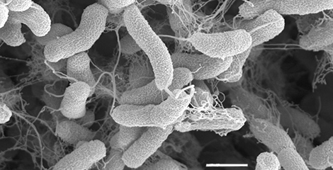 Vibrio cholerae. Raster-Elektronenmikroskopie. Maßstab = 1 µm. Quelle: © Muhsin Özel; Gudrun Holland/RKI