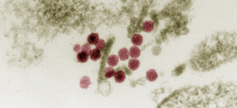 Elektronenmikroskopische Aufnahme von West-Nil-Viren. Quelle: © RKI