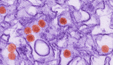 Zikaviren unter dem Elektronenmikroskop, kolorierte Aufnahme. Quelle: © Cynthia Goldsmith / CDC