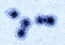 Elektronenmikroskopische Aufnahme von Schweres-akutes-respiratorisches-Syndrom-Coronaviren-2 (SARS-CoV-2), koloriert. Quelle: RKI