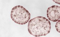 Electron microscopy of the Measles virus. Source: Hans Gelderblom/RKI