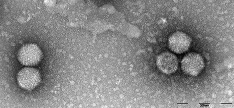 HAdV-5, Human adenovirus 5 (Human adenovirus C), HAdV-5, Human adenovirus 5 (Human adenovirus C). Transmission electron microscopy, negative staining. Quelle: © Lars Möller 2009/RKI