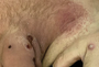 Hautveränderungen bei Mpox/Affenpocken. Quelle: Hammerschlag Y, 2022/Eurosurveillance
