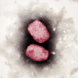 Elektronenmikroskopische Aufnahme von Monkeypox-Viren, koloriert. Quelle: © RKI