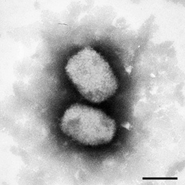 Affenpocken; MPXV, Monkeypox virus. Negativ-Kontrastierung; Elektronenmikroskopie; TEM; Viren; Poxviridae; Orthopoxvirus; DNA-Viren; Chordopoxvirinae. Bar = 200 nm. Quelle: © Andrea Männel/RKI