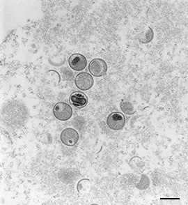 Mpox-Viren, MPXV, Monkeypox virus, Affenpocken. Ultradünnschnitt; ultrathin section; Elektronenmikroskopie; TEM; Viren; Poxviridae; Orthopoxvirus; DNA-Viren; Chordopoxvirinae. Quelle: © Freya Kaulbars / RKI
