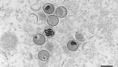 Affenpocken; MPXV, Monkeypox virus. Ultradünnschnitt; ultrathin section; Elektronenmikroskopie; TEM; Viren; Poxviridae; Orthopoxvirus; DNA-Viren; Chordopoxvirinae. Quelle: © Freya Kaulbars 2004/RKI