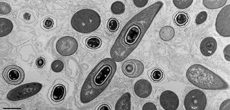 Bacillus anthracis, vegetative, sporenbildende Bakterien. Transmissions-Elektronenmikroskopie, Ultradünnschnitt (Schnelleinbettung). Maßstab = 1 μm. Quelle: © Lars Möller, Josef Schröder/RKI