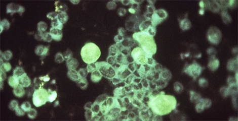 Cytomegalovirus human embryonic lung, MBA-CHV, 25X. Quelle: © Dr. Craig Lyerla 1977/CDC