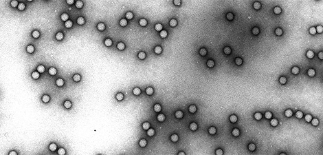 Enterovirus; PV, Poliovirus, Vergrößerung 180000–fach; negative staining; Negativ-Kontrastierung; Elektronenmikroskopie; TEM; Viren, Picornaviridae. Quelle: © Hans R. Gelderblom/RKI