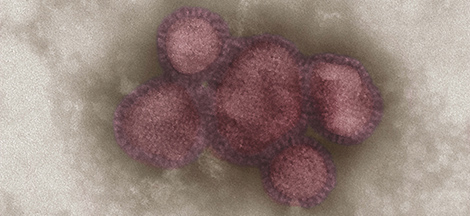 Elektronenmikroskopische Aufnahme von Influenza-Viren. Quelle: © Gudrun Holland/RKI