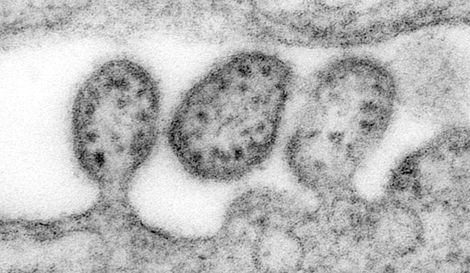 Stark vergrößerte Transmissionselektronenmikroskopie (TEM) von drei Lassa-Virus, Virionen. Quelle: © CDC/C. S. Goldsmith, D. Auperin 