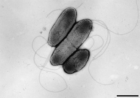 Burkholderia pseudomallei, begeißelte Bakterien. Transmissions-Elektronenmikroskopie, Negativkontrastierung. Maßstab = 1 μm. Quelle: © Hans R. Gelderblom, Gabi Schlier, Rolf Reissbrodt/RKI