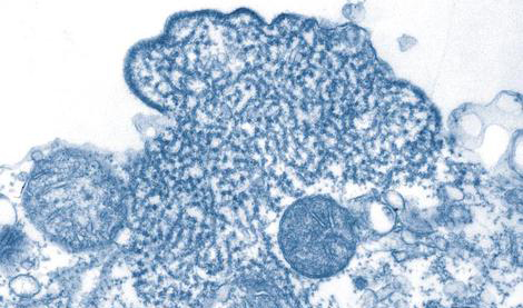 Nipah-Virus. Quelle: © CDC/ C. S. Goldsmith, P. E. Rollin