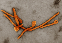 Elektronenmikroskopische Aufnahme von Ebolaviren (orange eingefärbt). Quelle: Hans Gelderblom/RKI